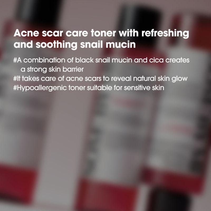 SOME BY MI - Snail Truecica Miracle Repair Toner, 150ml 3 SOME BY MI - Snail Truecica Miracle Repair Toner, 150ml - Image 2