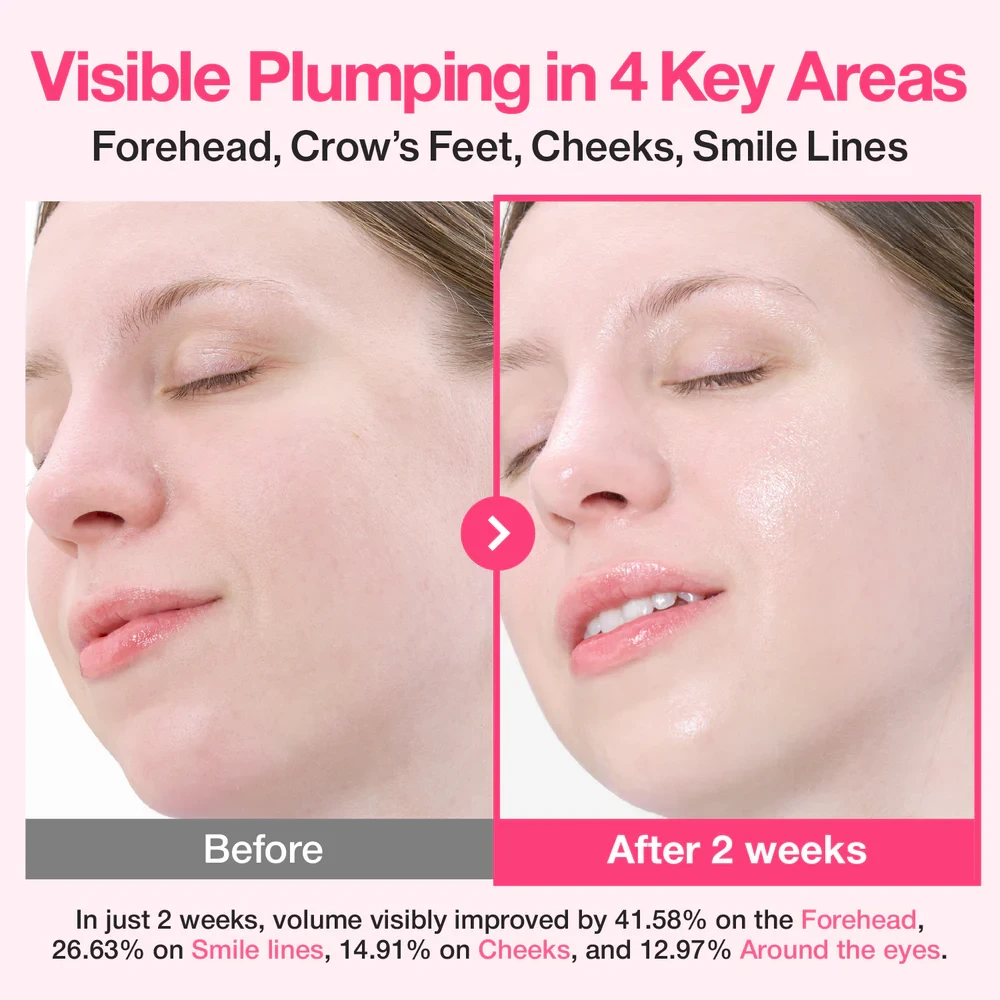 Numbuzin - No.2 Rose PDRN Collagen Plumping Serum DUO Trial Kit, 1.2ml*10ea 3 Numbuzin - No.2 Rose PDRN Collagen Plumping Serum DUO Trial Kit, 1.2ml*10ea - Image 2