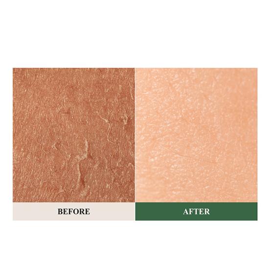 Herbloom - Green Papain Soft Peeling Gel, 120g 5 Herbloom - Green Papain Soft Peeling Gel, 120g - Image 4