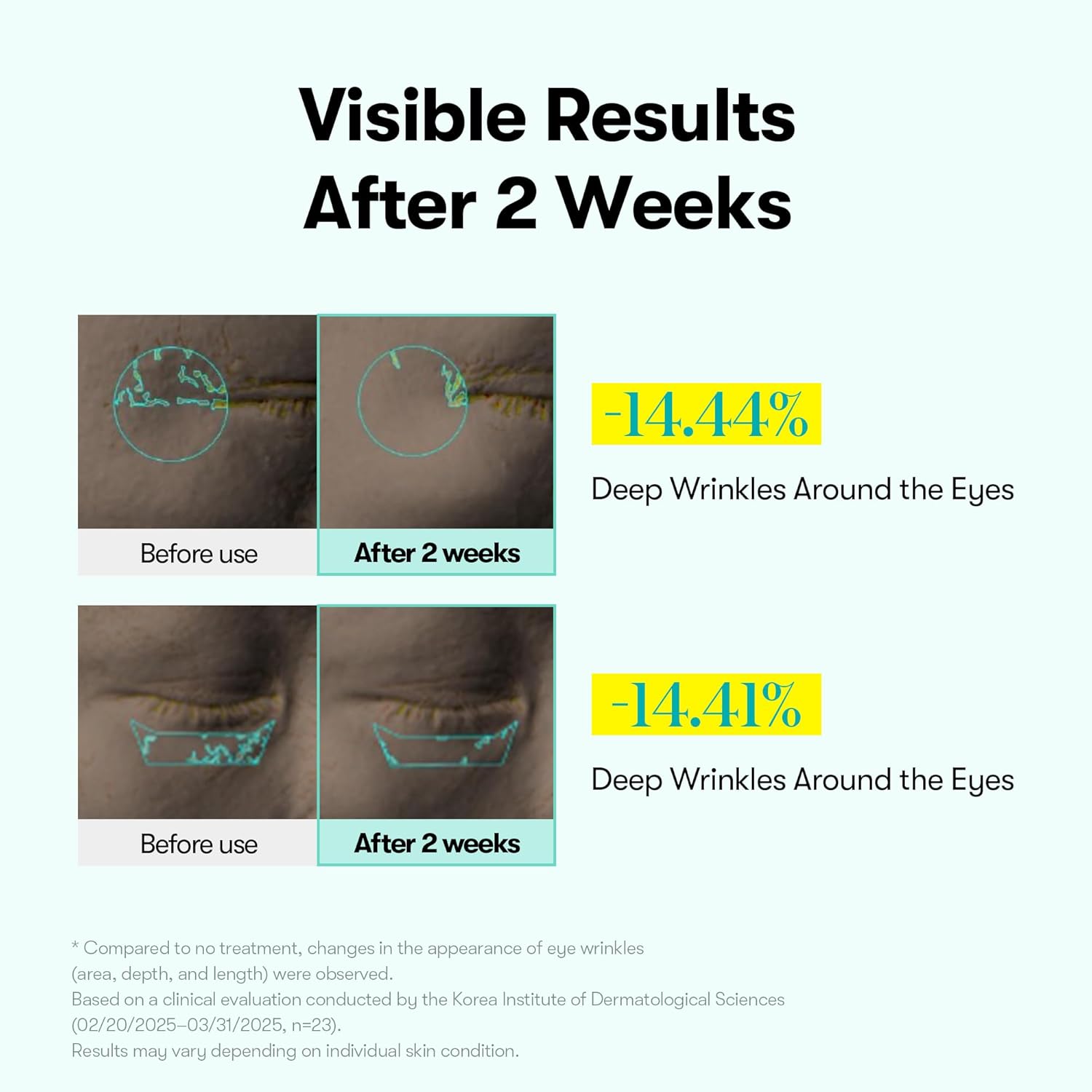 VT Cosmetics - PDRN Reedle Shot Eye Lifter, 15ml 7 VT Cosmetics - PDRN Reedle Shot Eye Lifter, 15ml - Image 6