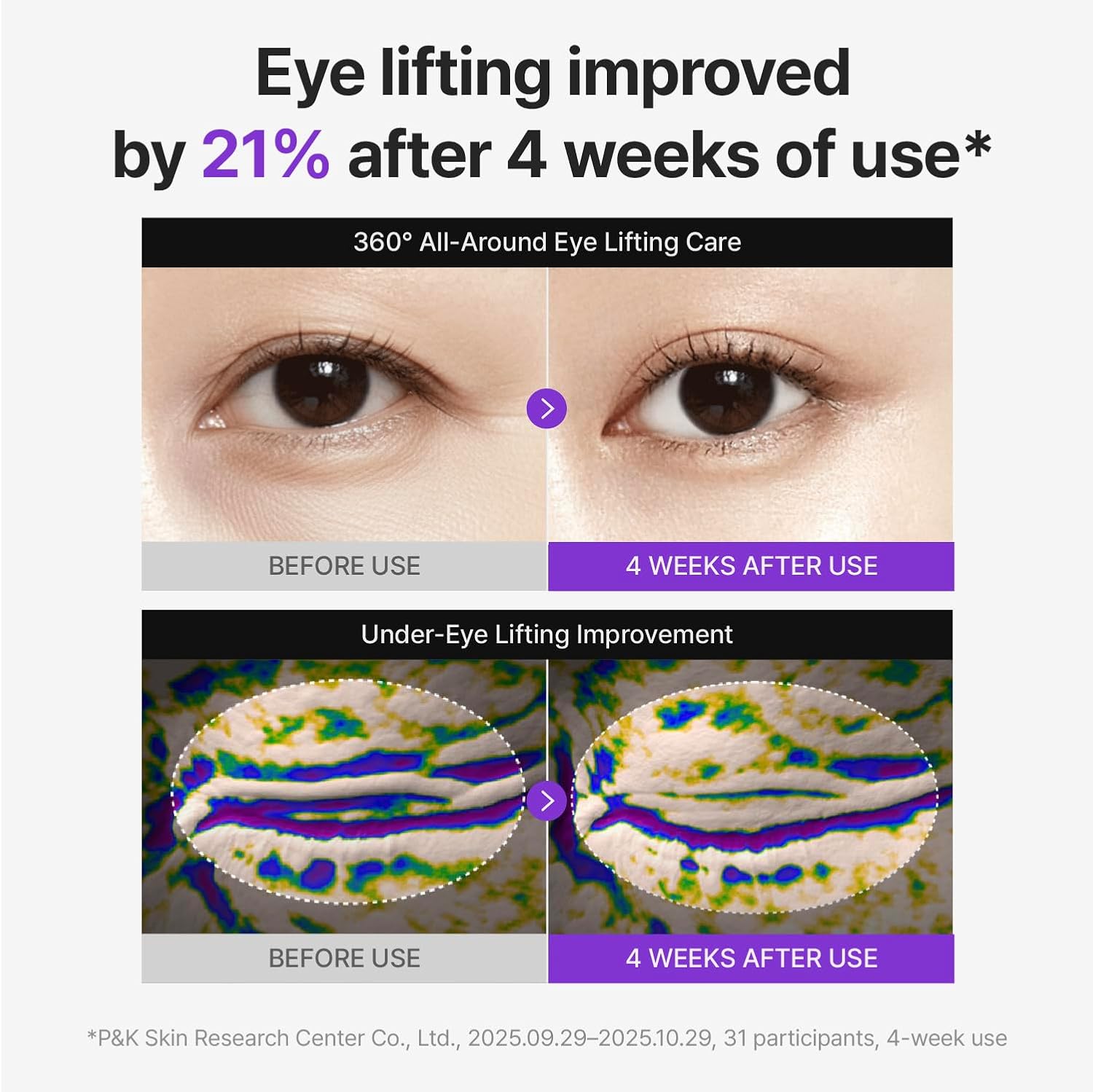 Centellian24 - 360º Shot PDRN Lifting Eye Cream, 30ml 6 Centellian24 - 360º Shot PDRN Lifting Eye Cream, 30ml - Image 5