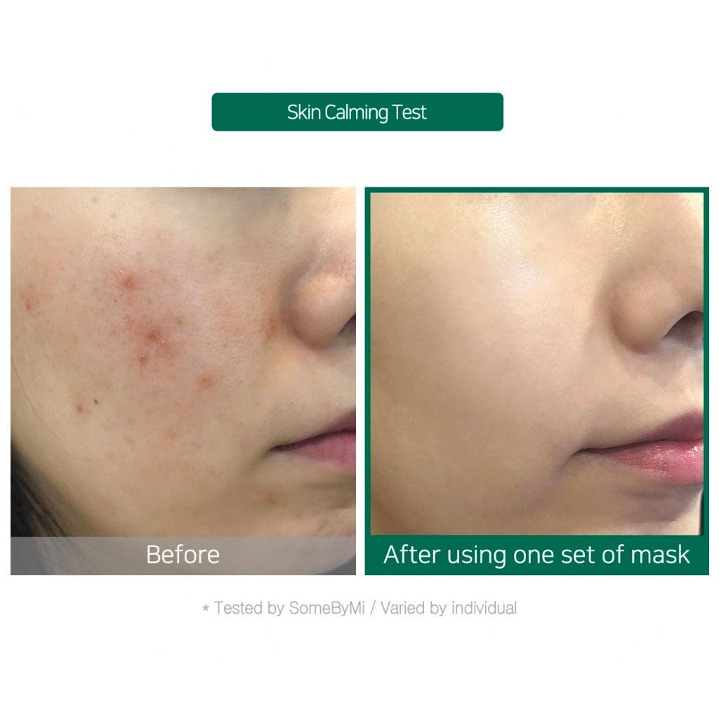 SOME BY MI - 30 Days Tea Tree Calming Glow Luminous Ampoule Mask, 25g, 1 piece 4 SOME BY MI - 30 Days Tea Tree Calming Glow Luminous Ampoule Mask, 25g, 1 piece - Image 3