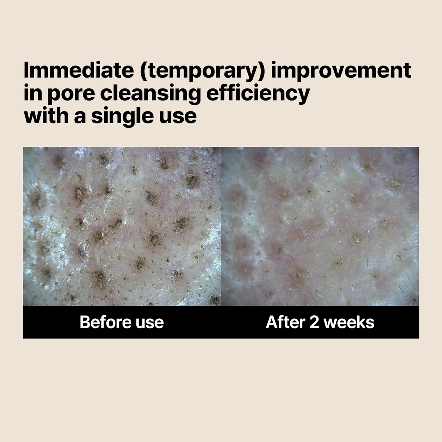 SOME BY MI - Lactosoy Enzyme Deep Cleansing Foam, 100ml 6 SOME BY MI - Lactosoy Enzyme Deep Cleansing Foam, 100ml - Image 5